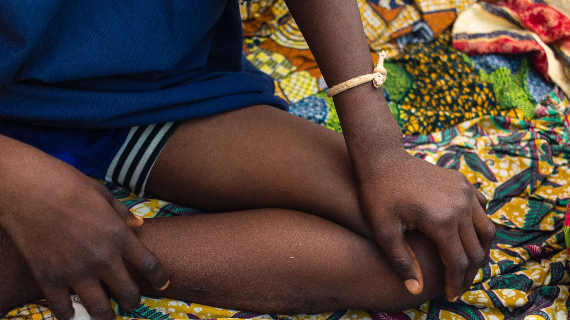 A child wears a bracelet believed to protect from illness. 