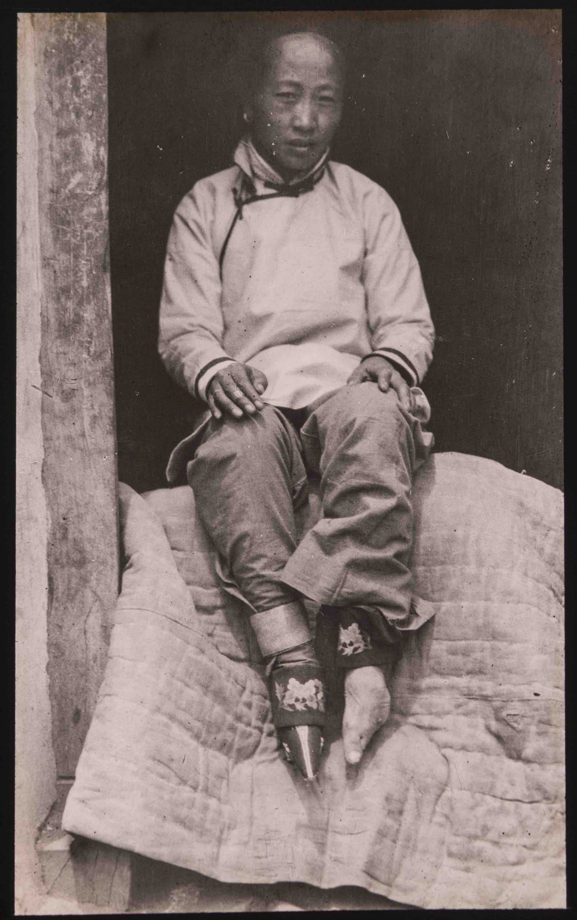 Chinese Woman with Bound Feet